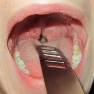 Toegangstijden | wachtlijstbemiddeling | 020-6 346 212