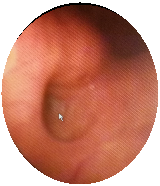 Buis van Eustachius | 020-6346212 | Bovenij ziekenhuis